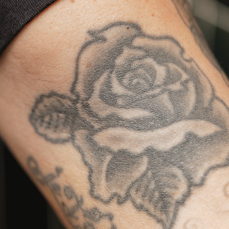 Black rose tattoo on a person's arm