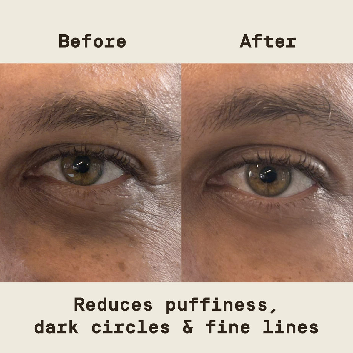 PAPATUI Holiday Under Eye Patches for Men - Made with Niacinamide, Hyaluronic Acid, Caffeine - For Puffy Eyes and Dark Circles - Limited Edition 4ct