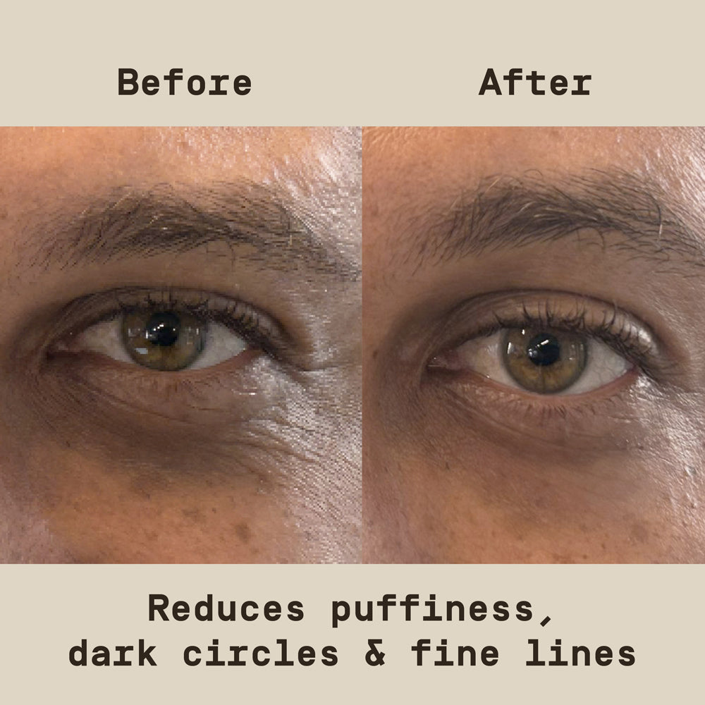 Two images of an eye and surrounding area with text above reading "Before" and "After," respectively, against a neutral background with text overlay that reads "Reduced puffiness, dark circles & fine lines"