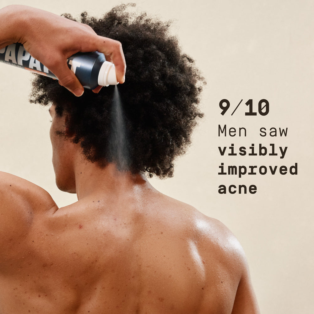 Person applying a product to their back with text about acne improvement.