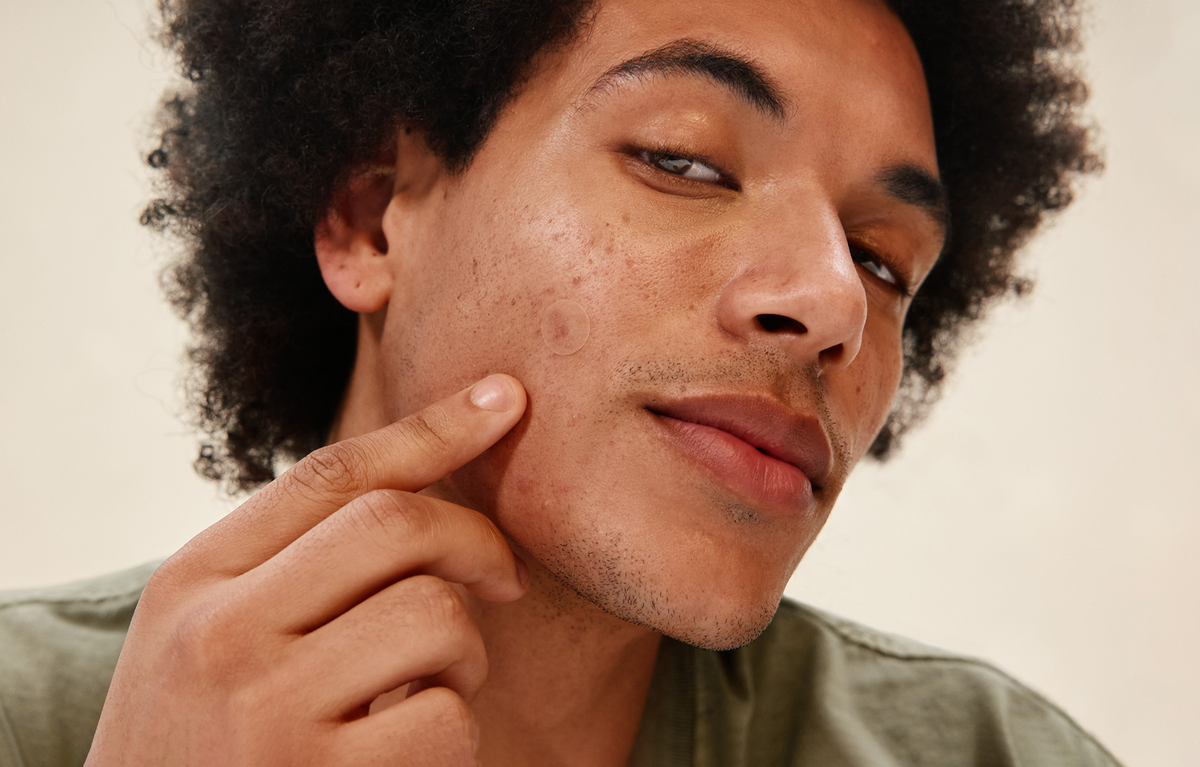 Acne Looks Different in Men