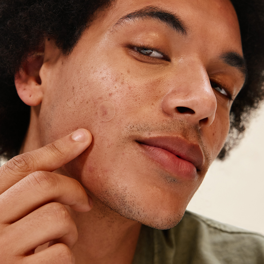 Close-up of a man applying a PAPATUI Pimple Patch to a blemish on his face against a neutral background