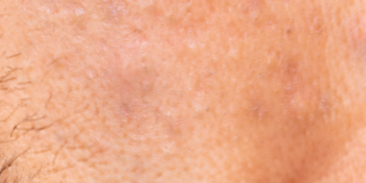 Close-up of skin