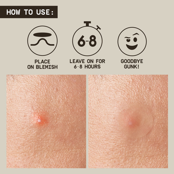 This image shows hwo to use the Papatui Pimple Patches.