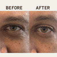 Ageless Action Technology Men's Under Eye Patch - 6 ct.