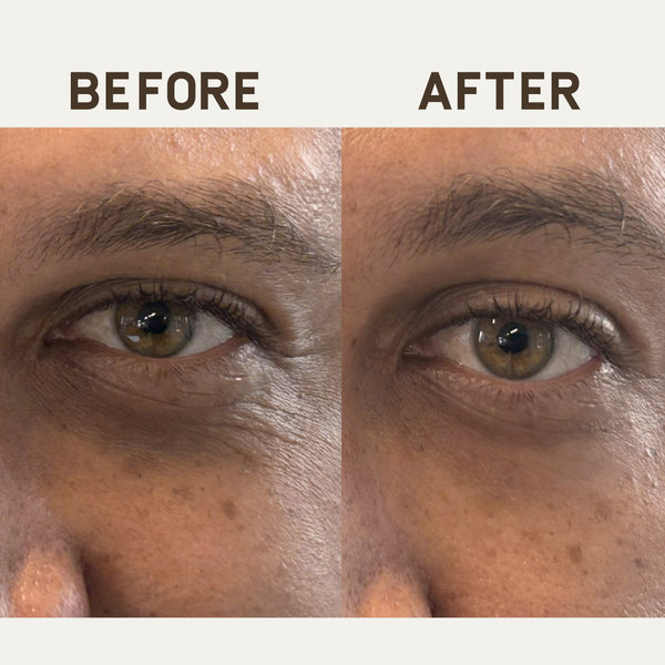 PAPATUI™ Ageless Action Under Eye Patches Side-by-side comparison images of a person's eye area before and after using the under-eye patches. The "Before" image shows visible puffiness and dark circles, while the "After" image highlights a smoother, brighter under-eye area.