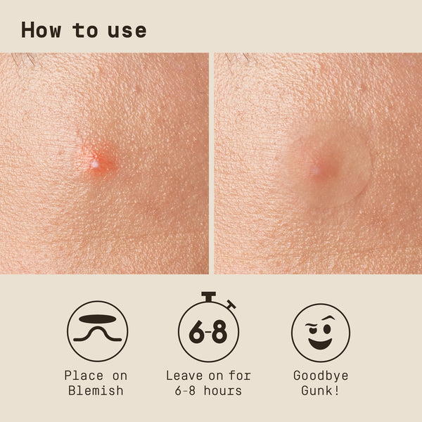 Instructions on how to use a skincare product with before and after effects shown. - Papatui Pimple Patches