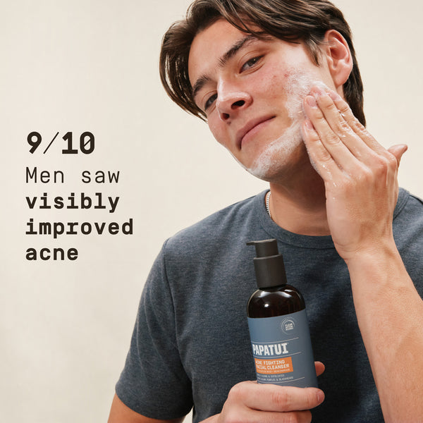 Man applying facial cleanser with text about acne improvement on a beige background