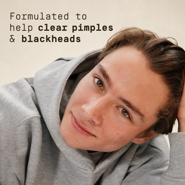 Man wearing a gray hoodie with text about skincare product benefits on a beige background reading "formulated to help clear pimples & blackheads"