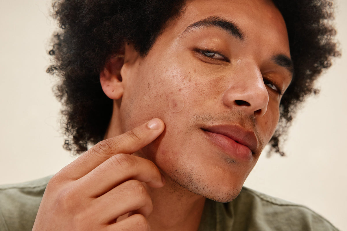 Close-up of man applying PAPATUI Pimple Patch to a blemish on his face against a neutral background